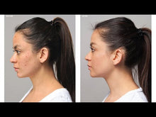 Load and play video in Gallery viewer, Acne Advanced 3-Step Treatment System